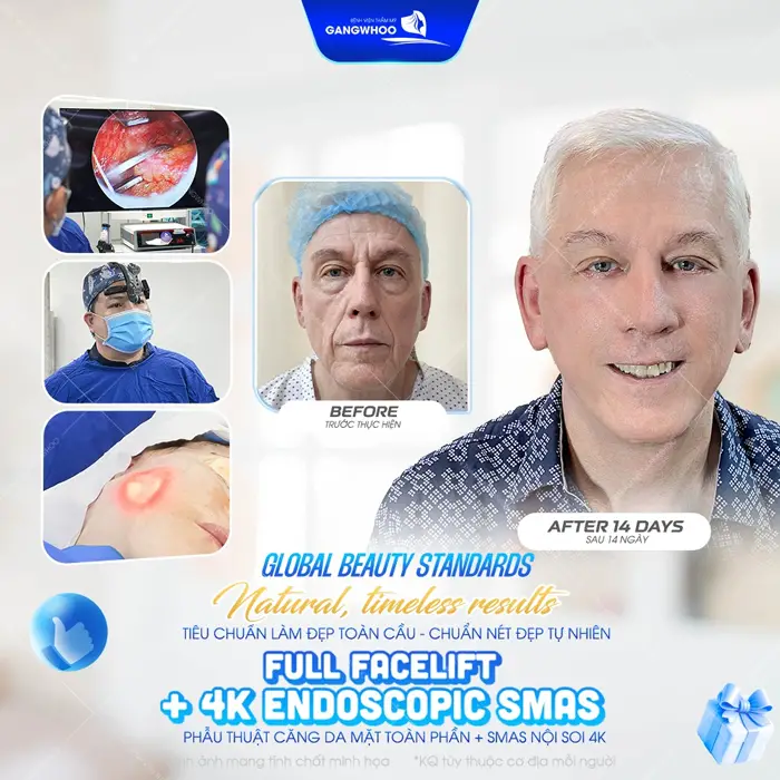 Top 8 Bác Sĩ Căng Da Mặt Nổi Tiếng Với Tay Nghề Cao