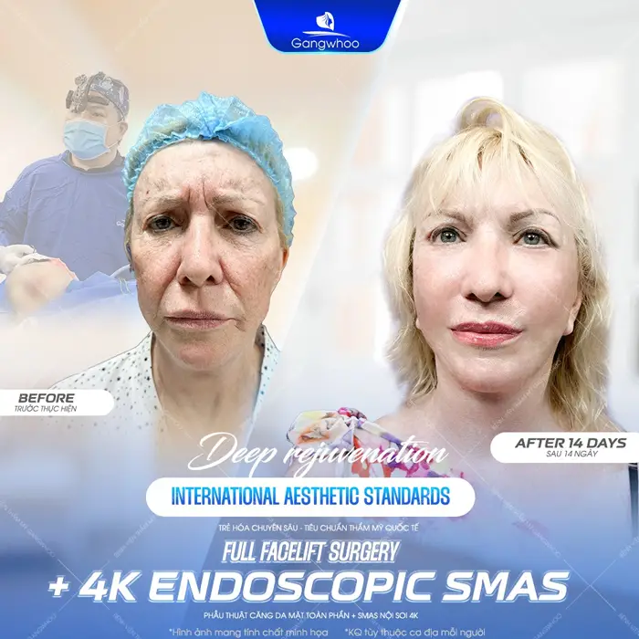 Top 8 Bác Sĩ Căng Da Mặt Nổi Tiếng Với Tay Nghề Cao