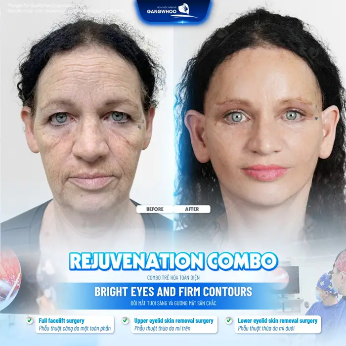 Top 8 Bác Sĩ Căng Da Mặt Nổi Tiếng Với Tay Nghề Cao