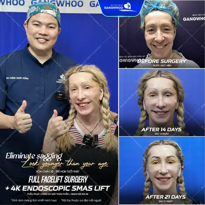 Top 8 Bác Sĩ Căng Da Mặt Nổi Tiếng Với Tay Nghề Cao