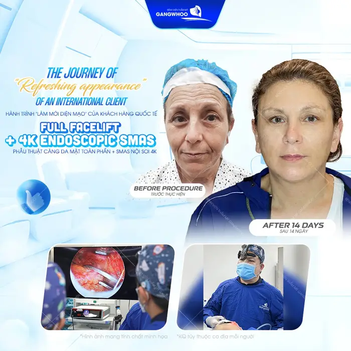 Top 8 Bác Sĩ Căng Da Mặt Nổi Tiếng Với Tay Nghề Cao