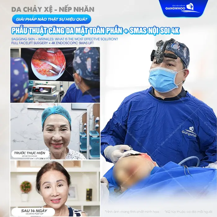 Top 8 Bác Sĩ Căng Da Mặt Nổi Tiếng Với Tay Nghề Cao