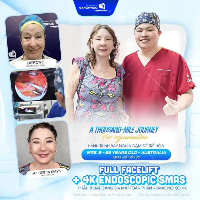 Top 8 Bác Sĩ Căng Da Mặt Nổi Tiếng Với Tay Nghề Cao