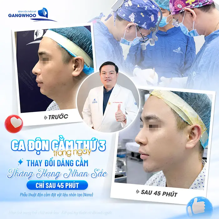 Thay đổi dáng cằm thăng hạng nhan sắc, gương mặt đẹp chuẩn tỷ lệ sau 45 phút đã hoàn toàn khác biệt