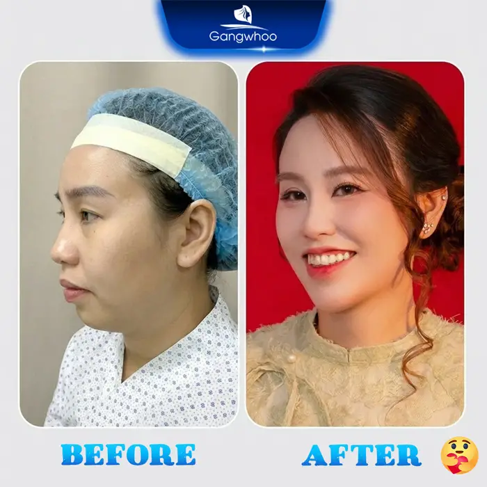 Top 11 Bác Sĩ Độn Cằm Giỏi Nhiều Người Tin Chọn Tại TPHCM