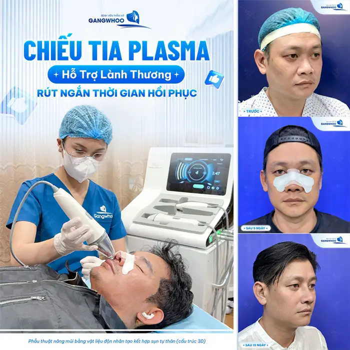 Chiếu tia Plasma hỗ trợ lành thương rút ngắn thời gian hồi phục an toàn, hiệu quả và tối ưu