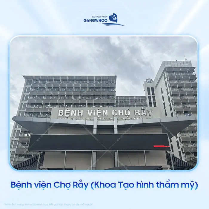 Top 10 Địa Chỉ Hút Mỡ Lưng Tại TPHCM Được Khách Hàng Lựa Chọn