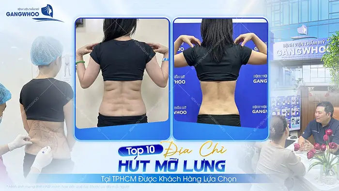 dia chi hut mo lung