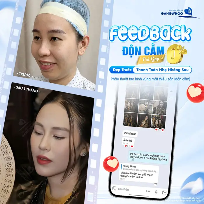 Top 9 Địa Chỉ Độn Cằm Tại TPHCM Được Chuyên Gia Đánh Giá Cao 9 Vóc dáng vòng 1 đẹp chuẩn sang với hỗ trợ trả góp làm đẹp nhẹ nhàng không lo áp lực tài chính