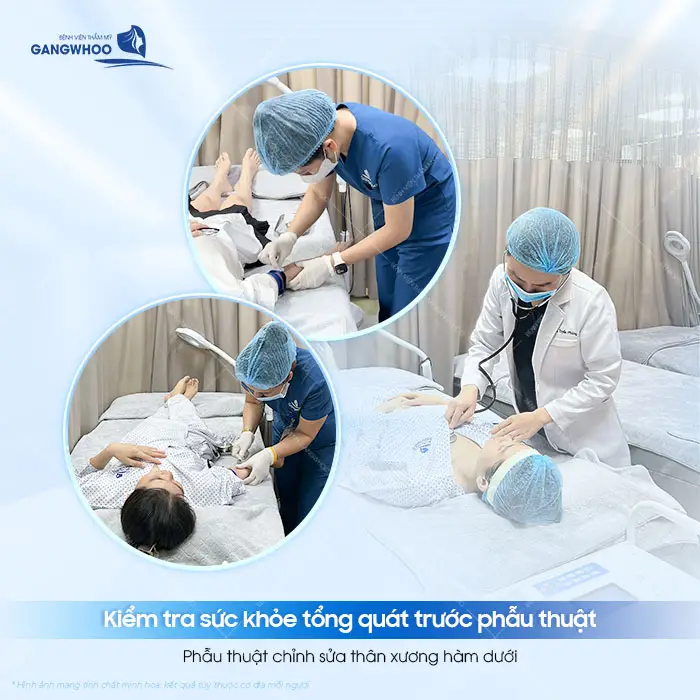 Gọt Hàm Có Bắt Vít Không? Vì Sao Phải Nẹp Vít?