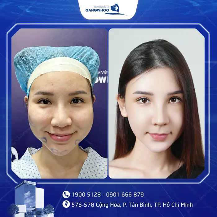 hinh anh khach hang got ham 13g