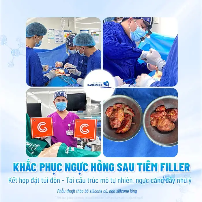 Sửa Ngực Hỏng Tiêm Filler: Cách Xử Lý An Toàn Và Hiệu Quả