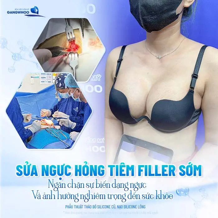 Sửa Ngực Hỏng Tiêm Filler: Cách Xử Lý An Toàn Và Hiệu Quả
