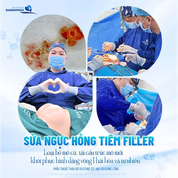 Sửa Ngực Hỏng Tiêm Filler: Cách Xử Lý An Toàn Và Hiệu Quả