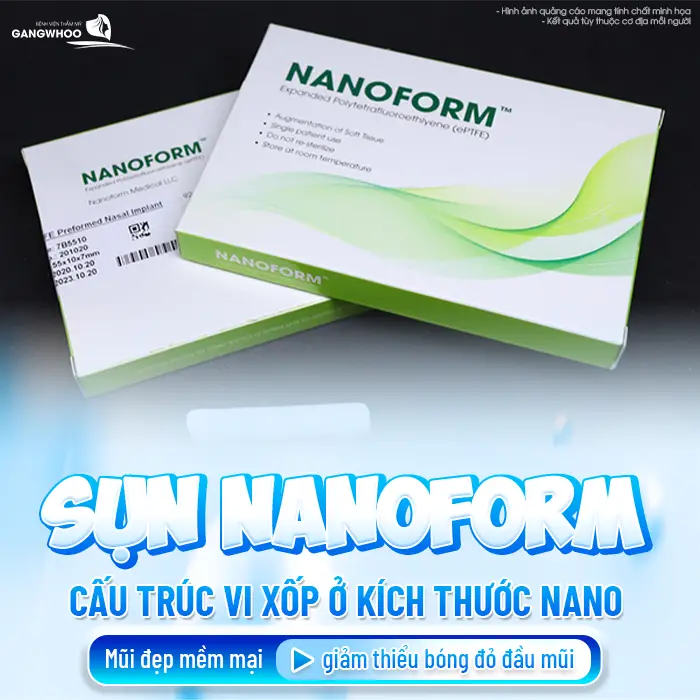 Top 10 Loại Sụn Nâng Mũi Phổ Biến Bác Sĩ Khuyên Dùng