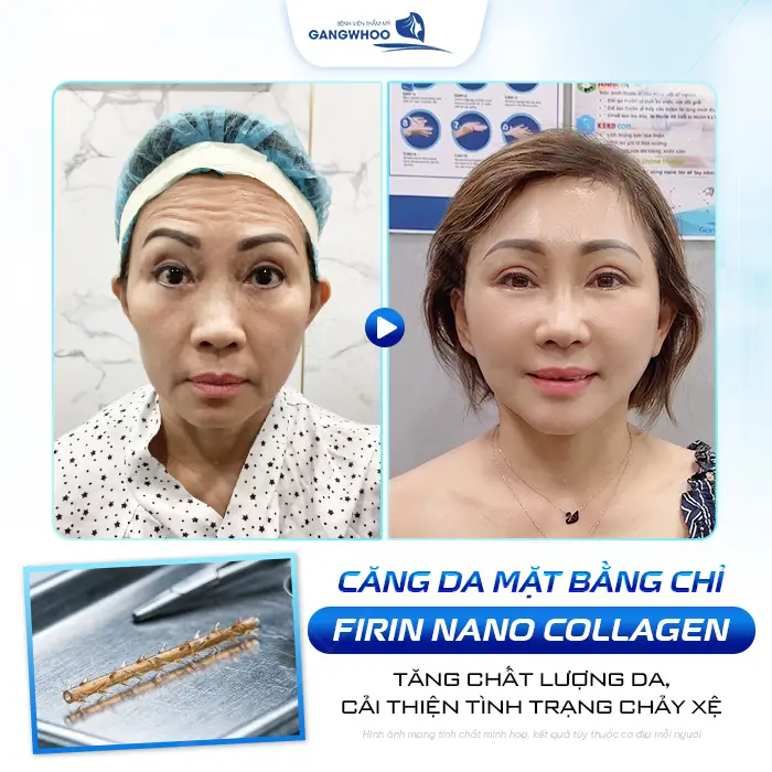 cang da mat bang chi