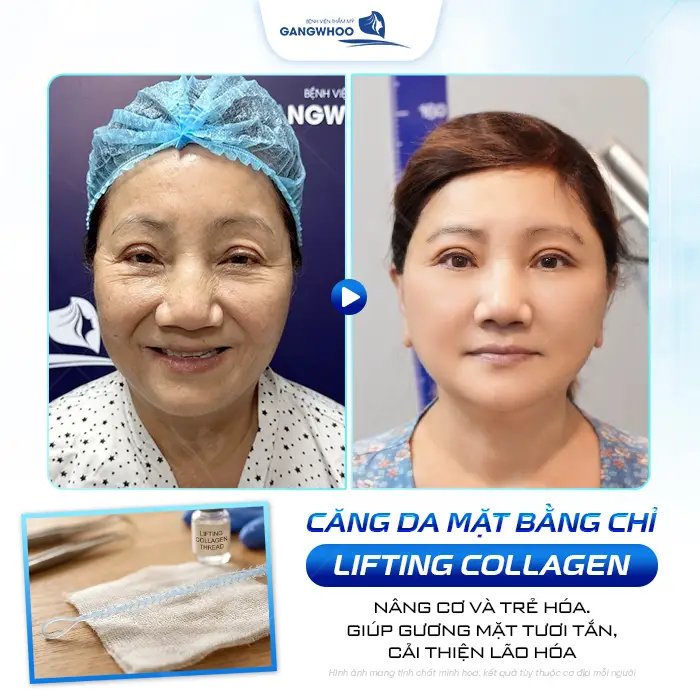cang da mat bang chi