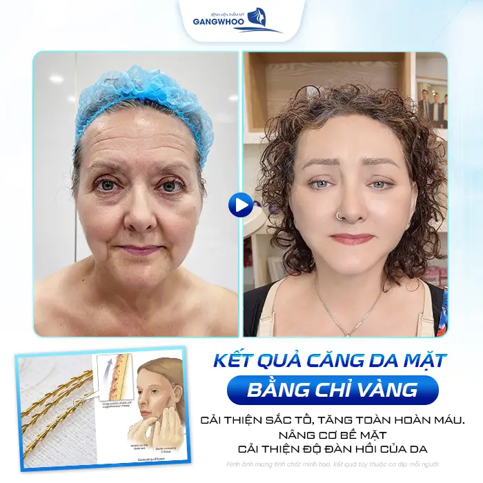 cang da mat bang chi