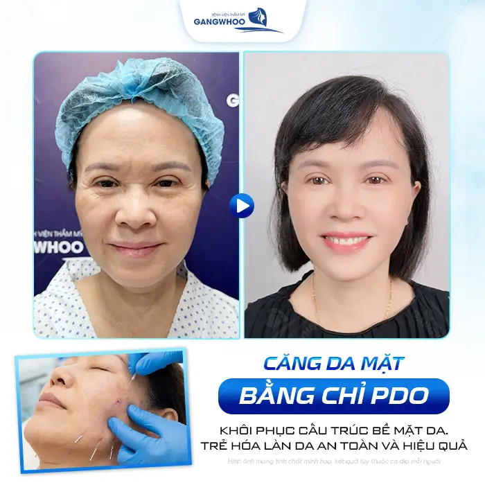 cang da mat bang chi