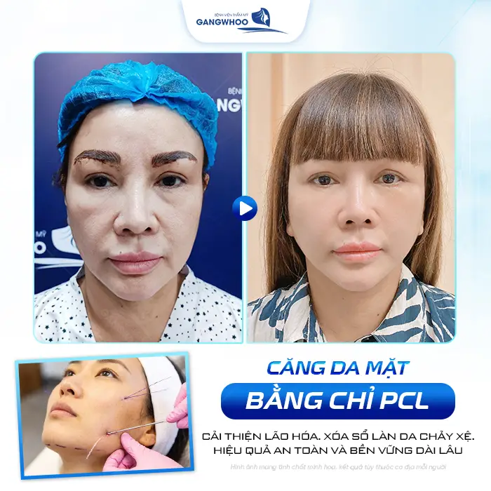 cang da mat bang chi