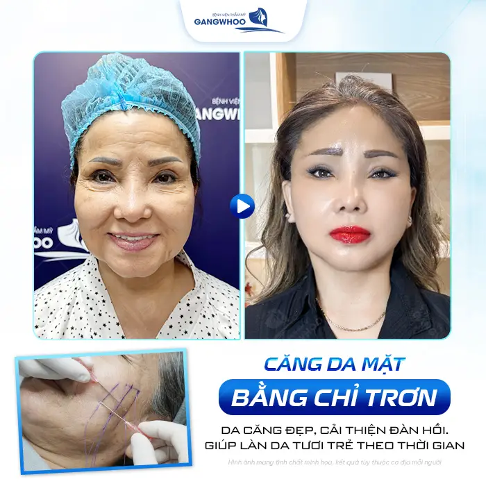cang da mat bang chi