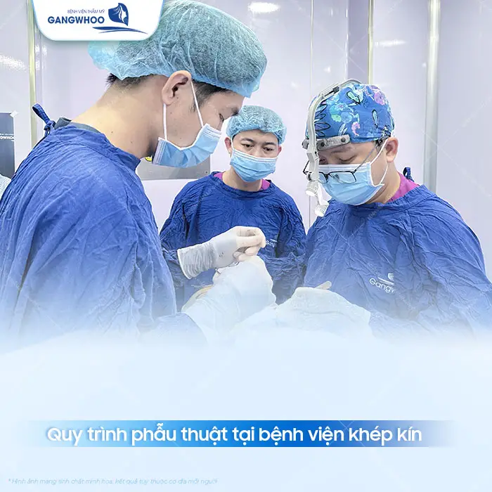 8 Loại Chỉ Căng Da Mặt Phổ Biến Bác Sĩ Khuyên Dùng Hiện Nay