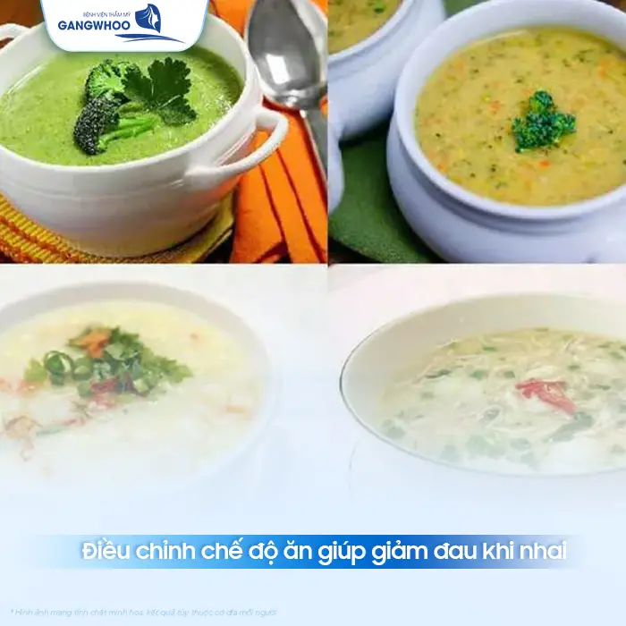 Đau Khi Ăn Nhai Sau Gọt Hàm Bao Lâu Hết? Bác Sĩ Giải Đáp