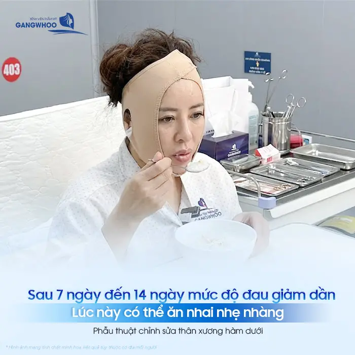 Đau Khi Ăn Nhai Sau Gọt Hàm Bao Lâu Hết? Bác Sĩ Giải Đáp