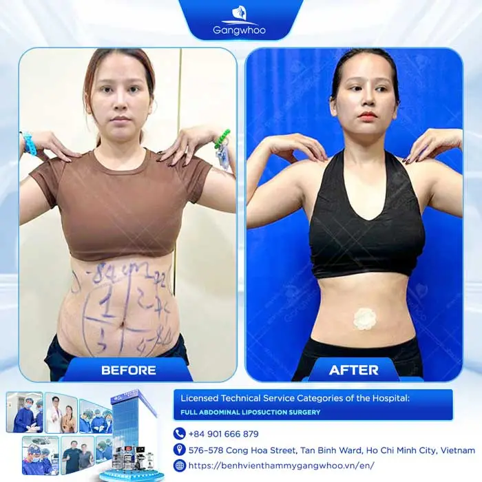 lipo 6