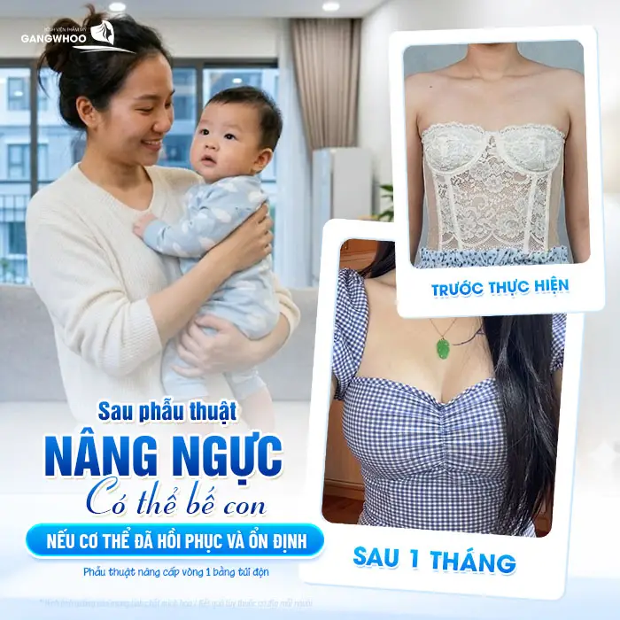 Nâng Ngực Bao Lâu Thì Bế Con Được? Hướng Dẫn Bế Con An Toàn