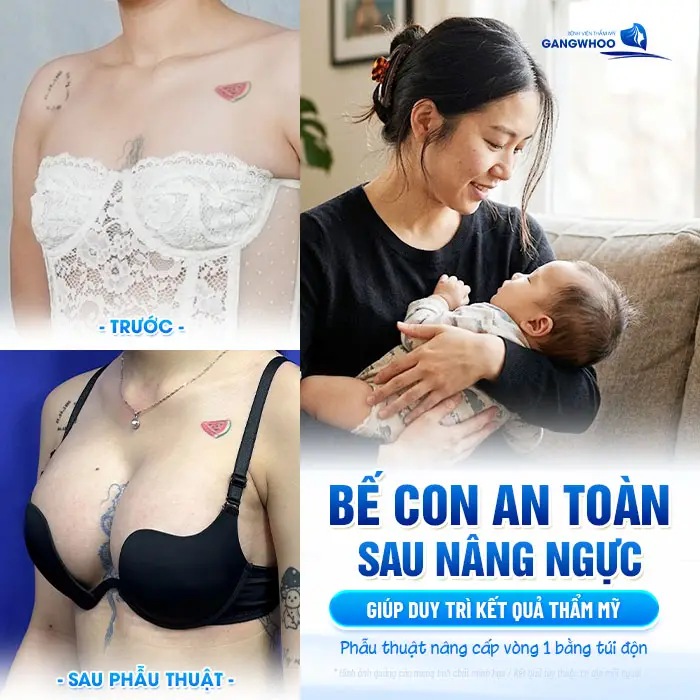Nâng Ngực Bao Lâu Thì Bế Con Được? Hướng Dẫn Bế Con An Toàn
