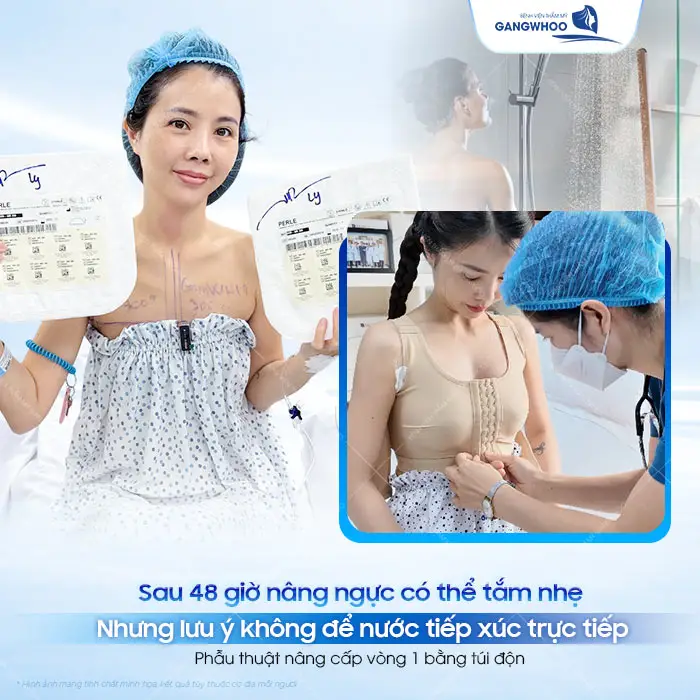 Nâng Ngực Bao Lâu Thì Tắm Được? Hướng Dẫn Vệ Sinh Đúng Cách