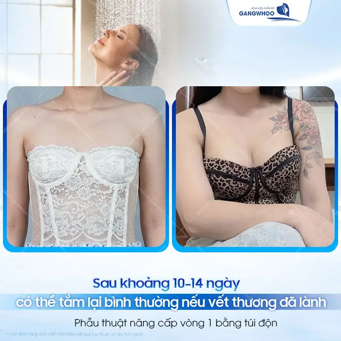 Nâng Ngực Bao Lâu Thì Tắm Được? Hướng Dẫn Vệ Sinh Đúng Cách