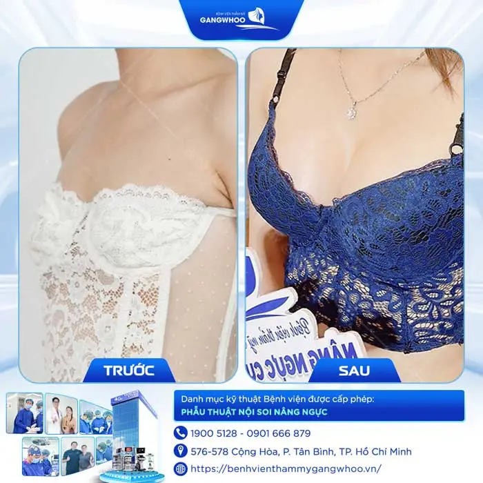 nang nguc tv 1
