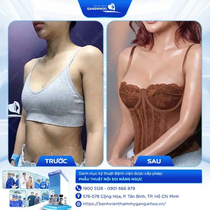 nang nguc tv 3