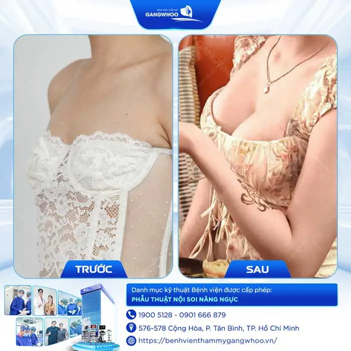 nang nguc tv 4