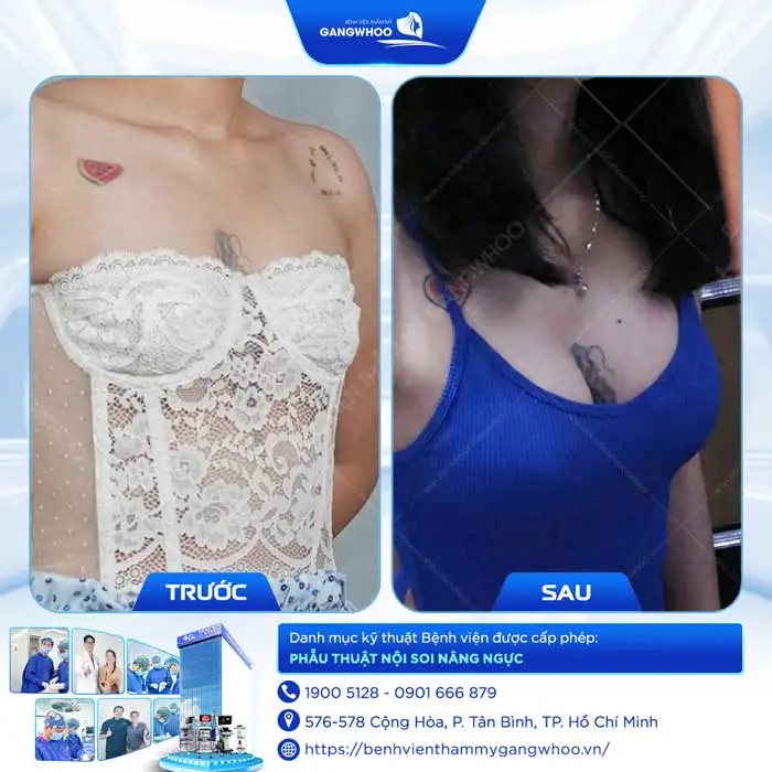 nang nguc tv