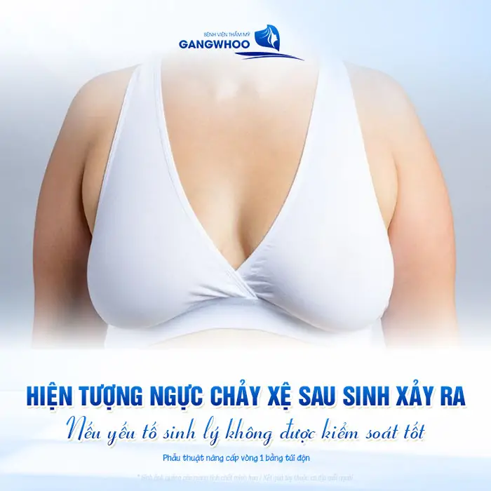 Nâng Ngực Xong Cho Con Bú Có Bị Xệ Không? Bác Sĩ Giải Đáp
