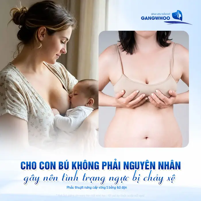 Nâng Ngực Xong Cho Con Bú Có Bị Xệ Không? Bác Sĩ Giải Đáp