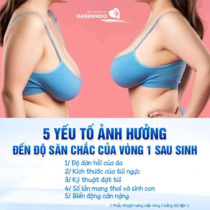 Nâng Ngực Xong Cho Con Bú Có Bị Xệ Không? Bác Sĩ Giải Đáp