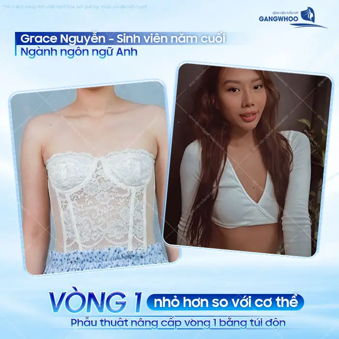 Sinh Viên Năm Cuối Ngành Ngôn Ngữ Anh “Lột Xác” Vòng 1 Tại Gangwhoo 1 Sinh Viên Năm Cuối Ngành Ngôn Ngữ Anh “Lột Xác” Vòng 1 Tại Gangwhoo