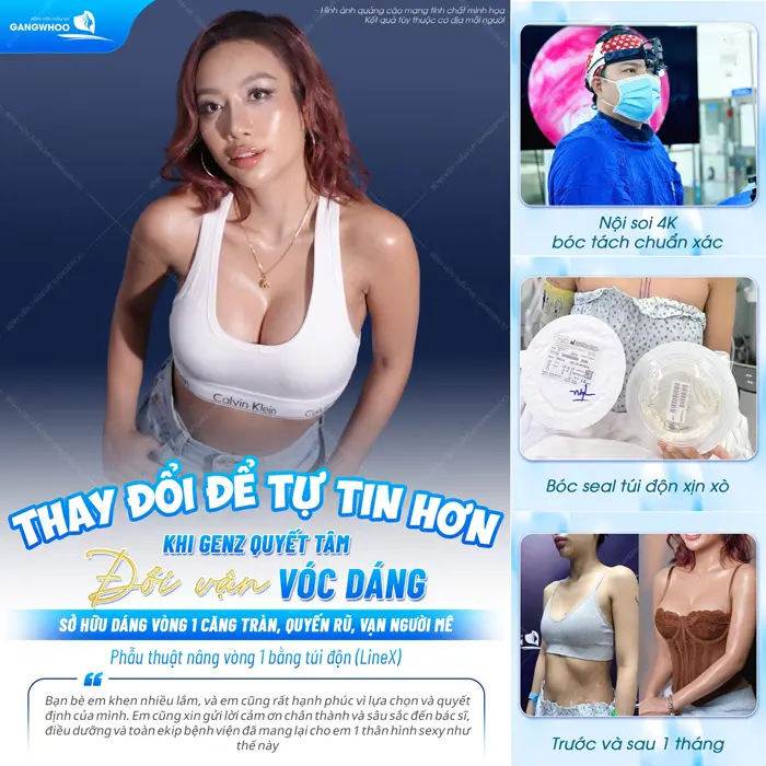 Sinh Viên Năm Cuối Ngành Ngôn Ngữ Anh “Lột Xác” Vòng 1 Tại Gangwhoo 5 Thay đổi để tự tin hơn, cô nàng GenZ bày tỏ sự hài lòng về kết quả sau phẫu thuật nâng ngực