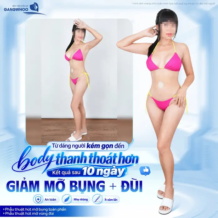 Từ dáng kém gọn đến body thanh thoát sau 10 ngày giảm mỡ bụng