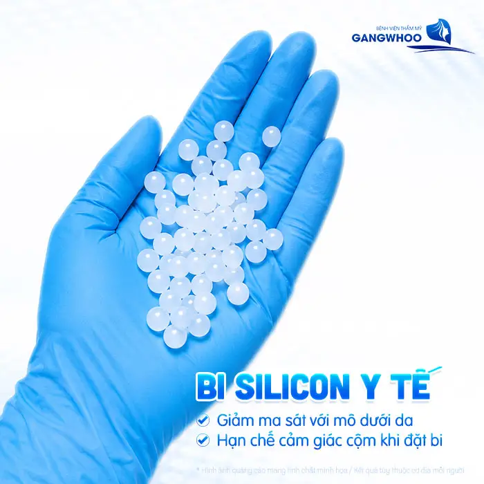 6 Loại Bi Dùng Gắn Bi Dương Vật Thường Dùng Trong Y Khoa