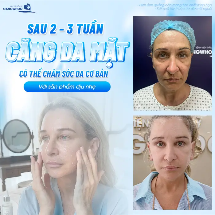 Sau Căng Da Mặt Bao Lâu Được Làm Liệu Trình Da? Bác Sĩ Giải Đáp