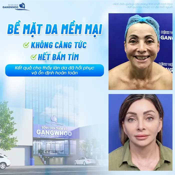 Sau Căng Da Mặt Bao Lâu Được Làm Liệu Trình Da? Bác Sĩ Giải Đáp