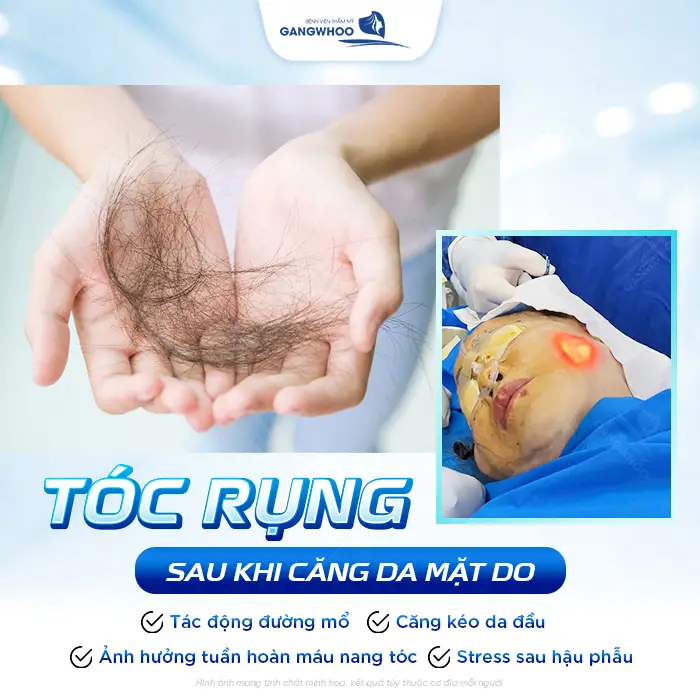 Căng Da Mặt Tóc Bao Lâu Mọc Lại? Bác Sĩ Thẩm Mỹ Giải Đáp