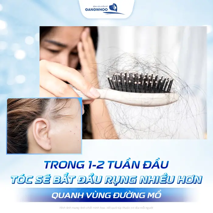 Căng Da Mặt Tóc Bao Lâu Mọc Lại? Bác Sĩ Thẩm Mỹ Giải Đáp