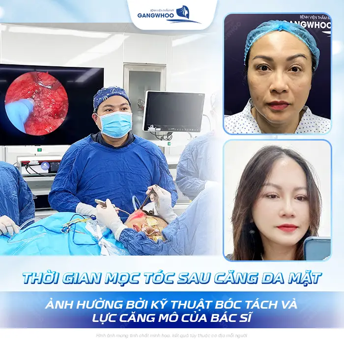 Căng Da Mặt Tóc Bao Lâu Mọc Lại? Bác Sĩ Thẩm Mỹ Giải Đáp
