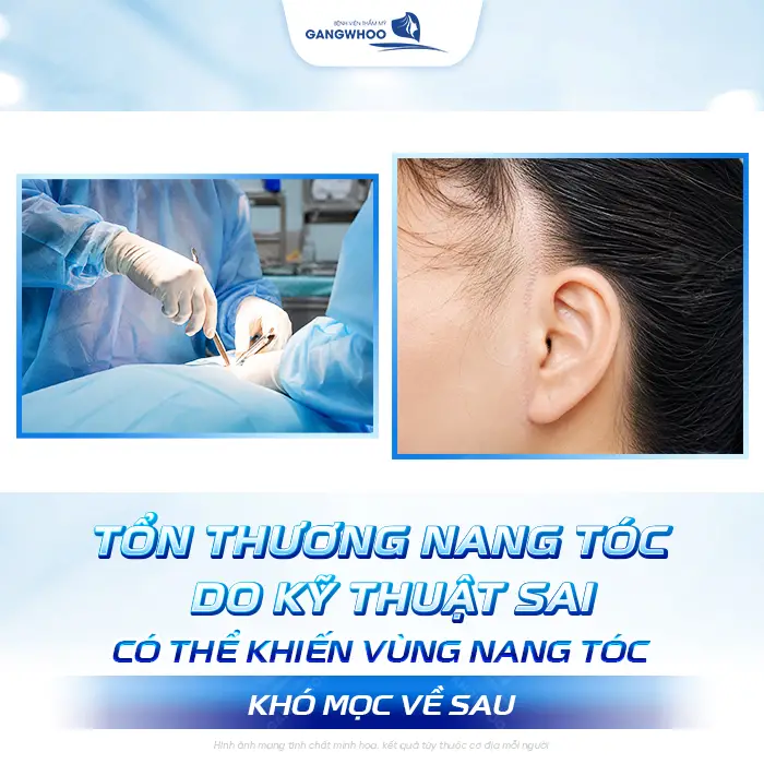 Căng Da Mặt Tóc Bao Lâu Mọc Lại? Bác Sĩ Thẩm Mỹ Giải Đáp